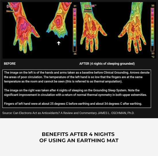 Benefits After 4 Nights of Using an Earthing Mat